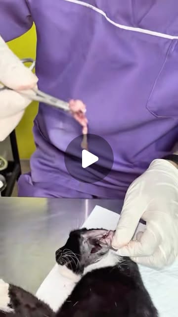 Ear Polyp , Buang ketumbuhan dalam telinga