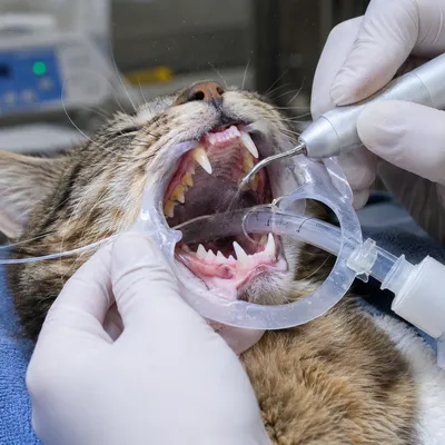 Dental Scaling